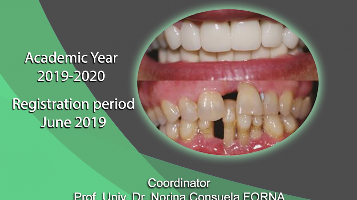 Master International – Implanto Prothetic Rehabilitation of Edentulous
